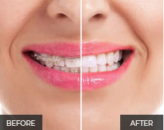 General and Cosmetic dentist in Dubai